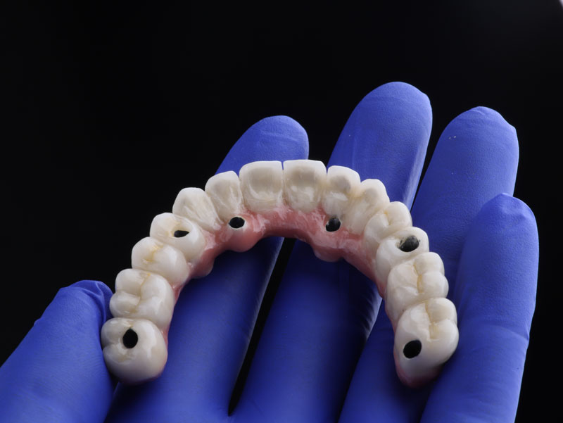 Discover the Magic of Snap-on Dentures in Aurora, CO with Dr. Lee Seung