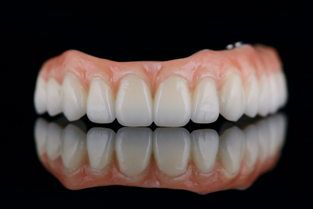 Full Mouth Implants: The Modern Solution for Replacing Missing teeth